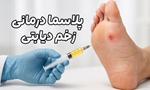  افتتاح کلینیک زخم دیابت با استفاده از فناوری پلاسما سرد در سبزوار