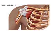 ترمیم پارگی روتاتورکاف شانه برای نخستین بار در بیمارستان قمربنی هاشم(ع) جوین