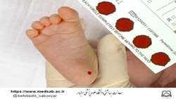 آزمایش 7430 کودک متولد شده در سال 98 از نظر  کم کاری تیروئید در دانشگاه علوم پزشکی سبزوار